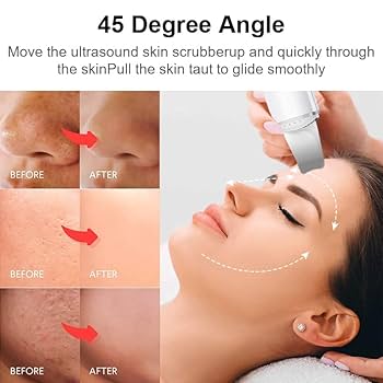 Face Blackhead Remover